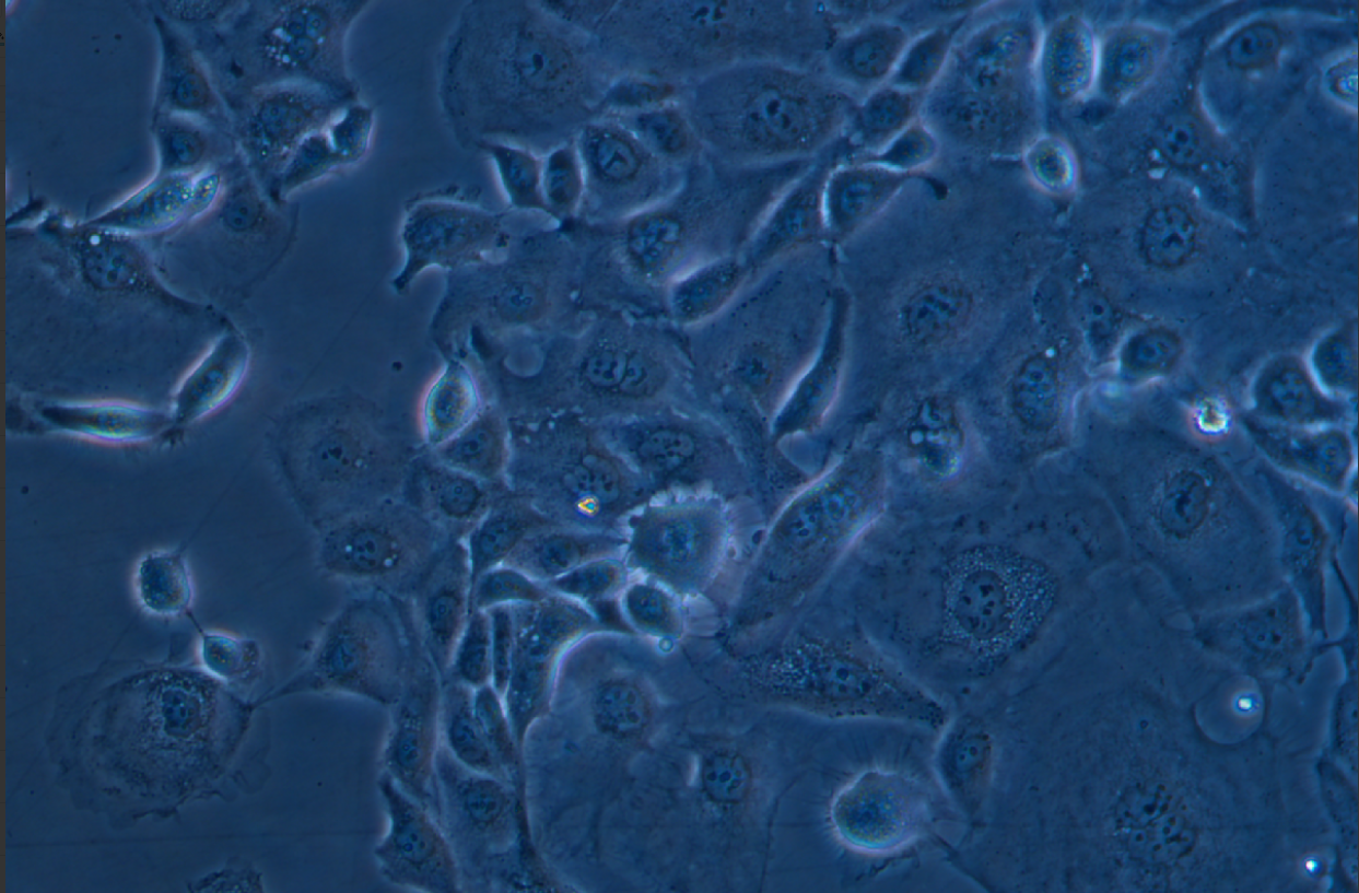 人子宮內膜癌細胞KLE (STR鑒定正確)