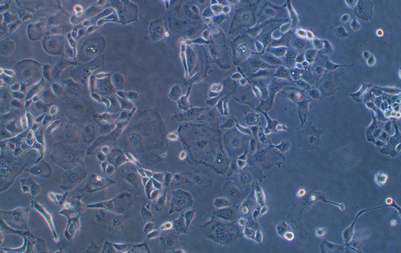 人子宮內膜癌細胞KLE (STR鑒定正確)