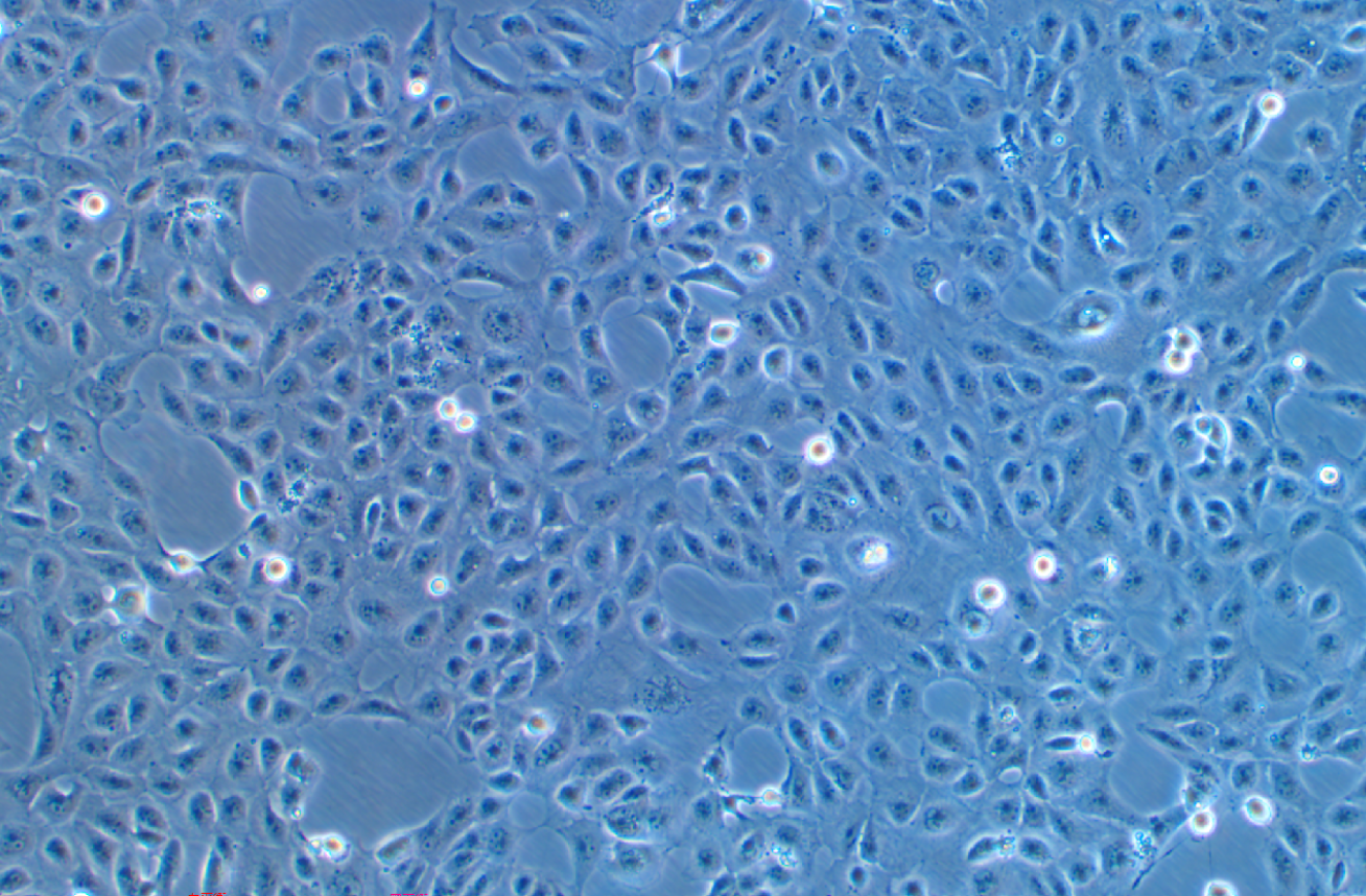 人腎小管上皮細胞HK-2(STR鑒定正確)