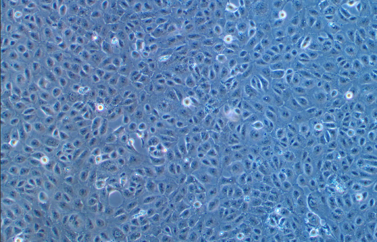 人腎小管上皮細胞HK-2(STR鑒定正確)