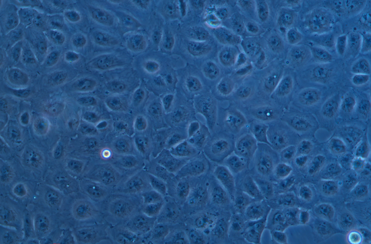 人腎小管上皮細胞HK-2(STR鑒定正確)