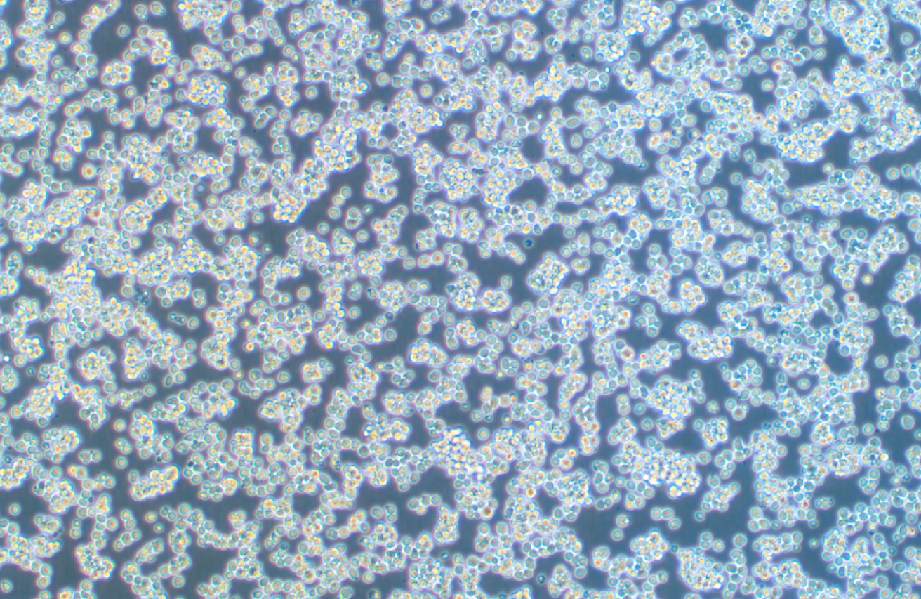 小鼠B細胞淋巴瘤A20(種屬鑒定)