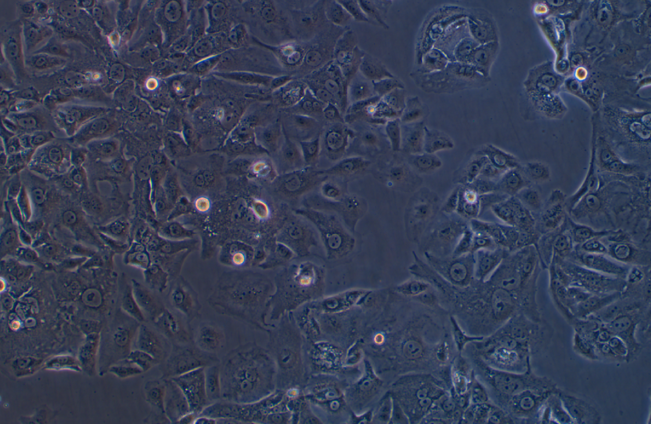 人卵巢癌細(xì)胞UWB1.289(STR鑒定正確)