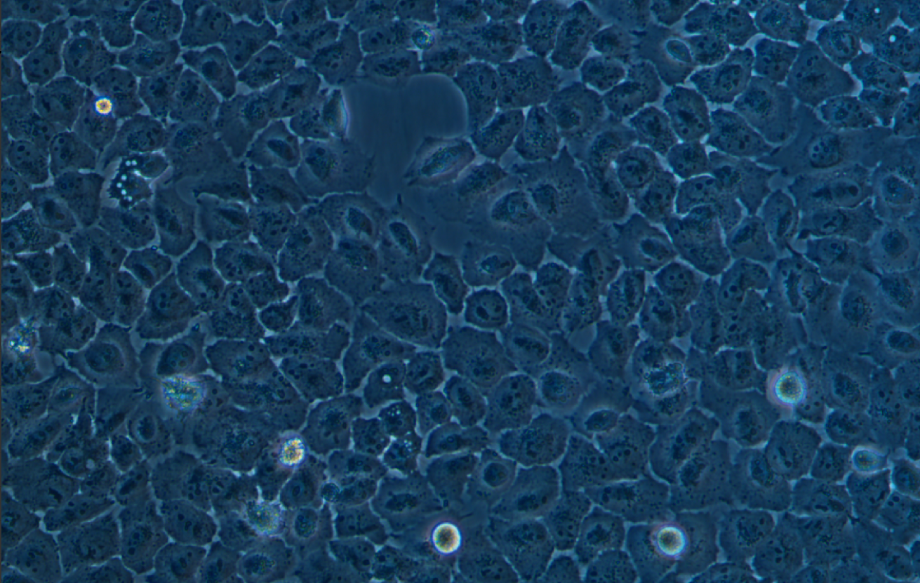 人涎腺腺樣囊性癌細(xì)胞SACC-83(STR鑒定正確)