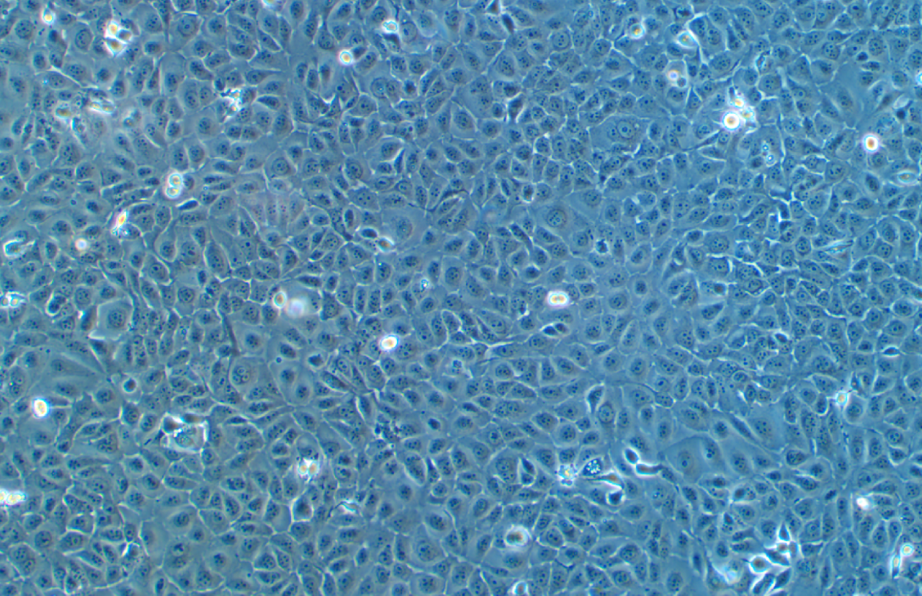人角膜上皮細胞系 HCE-T(STR鑒定正確)