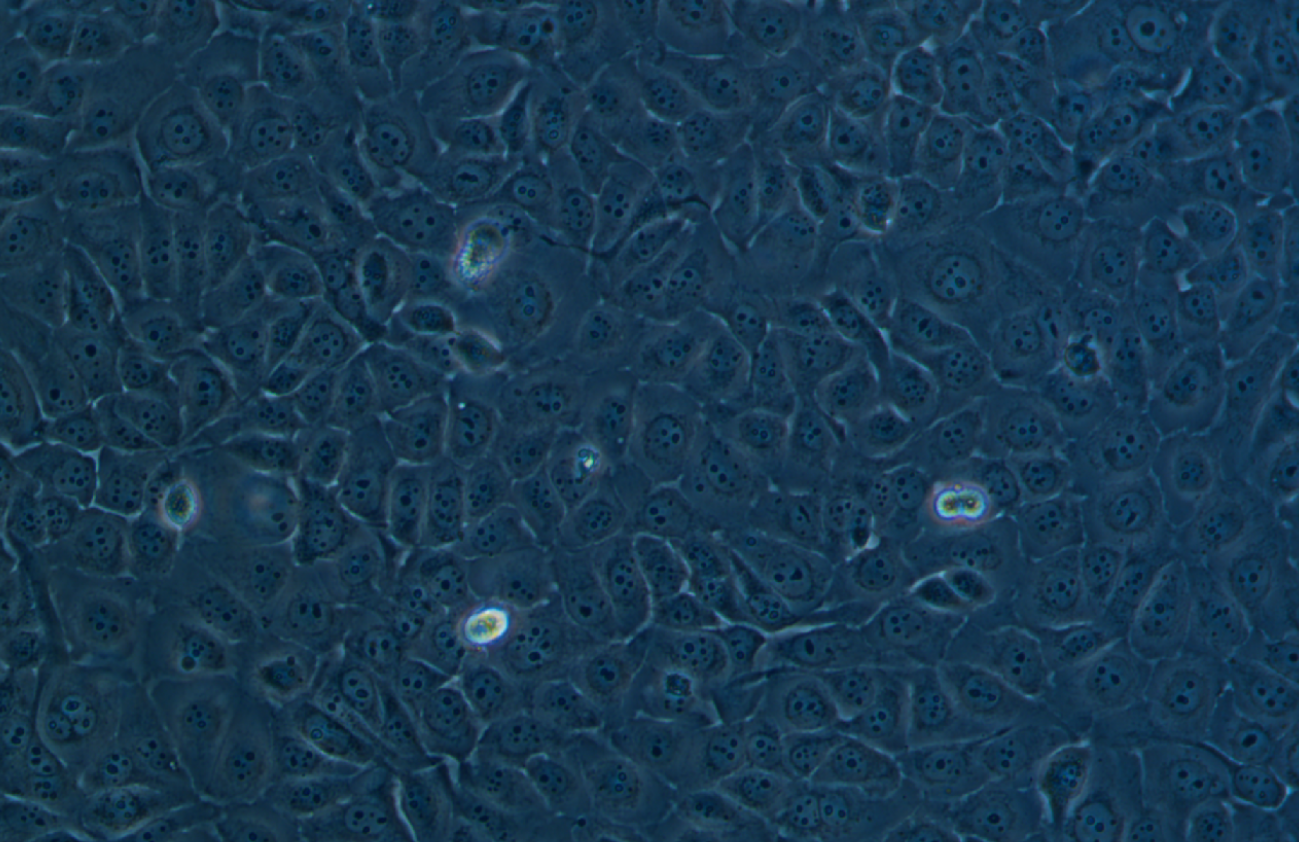 人角膜上皮細胞系 HCE-T(STR鑒定正確)