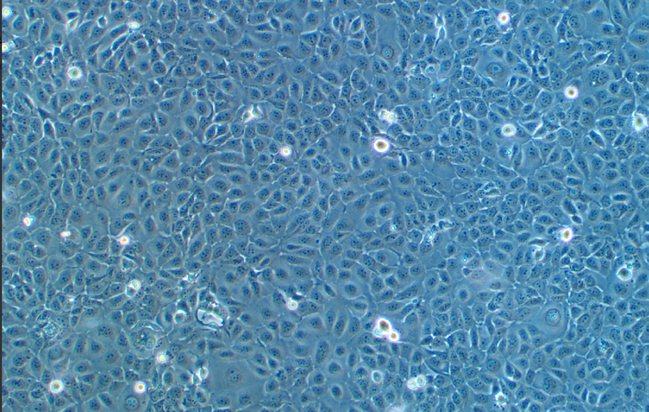 人角膜上皮細胞系 HCE-T(STR鑒定正確)