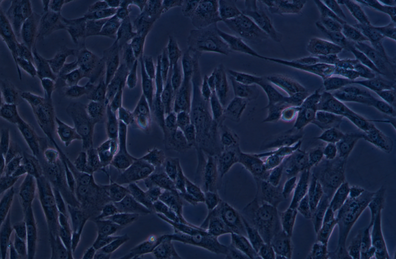 人滑膜肉瘤細胞SW 982(STR鑒定正確)
