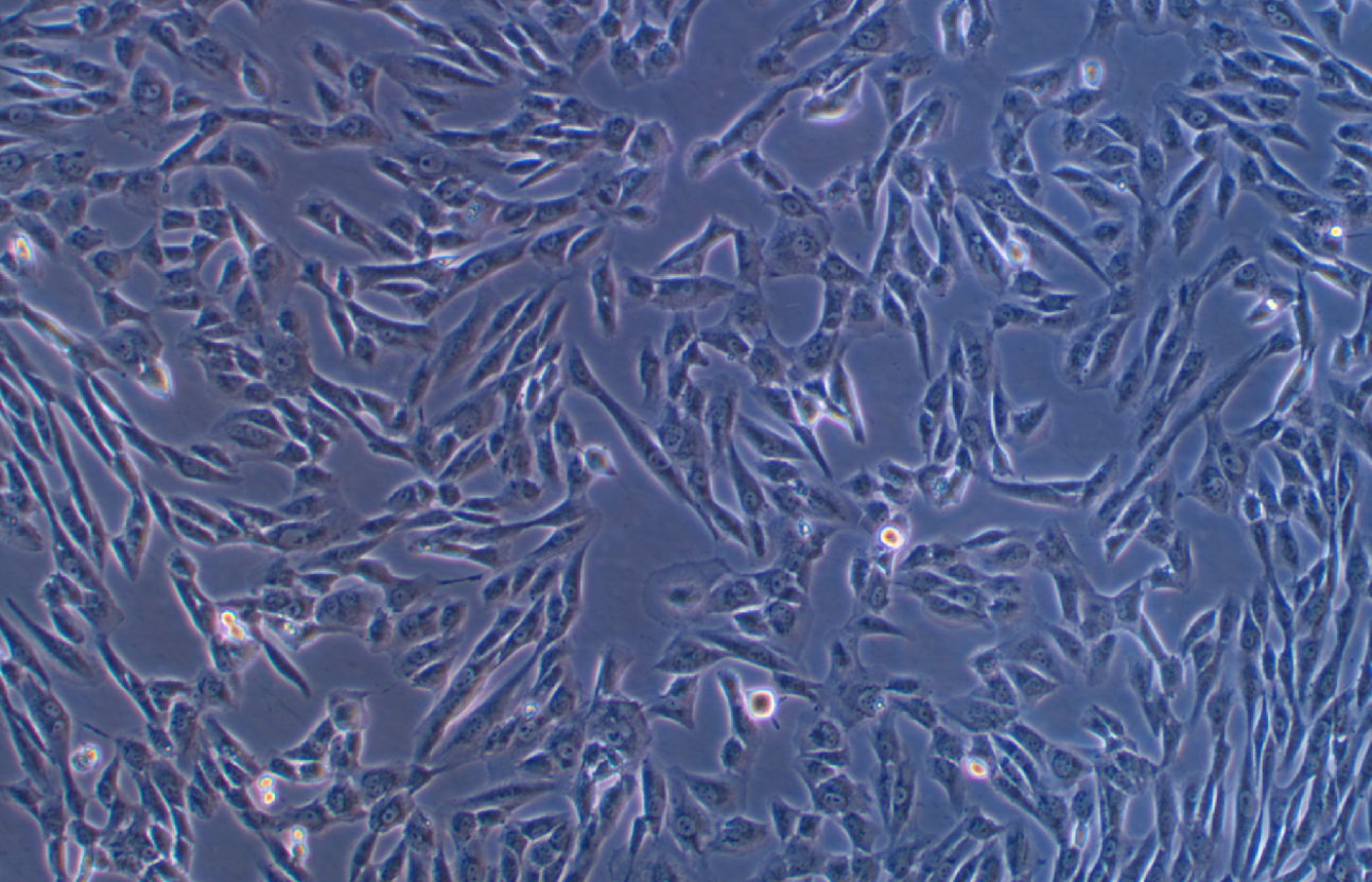 人滑膜肉瘤細胞SW 982(STR鑒定正確)