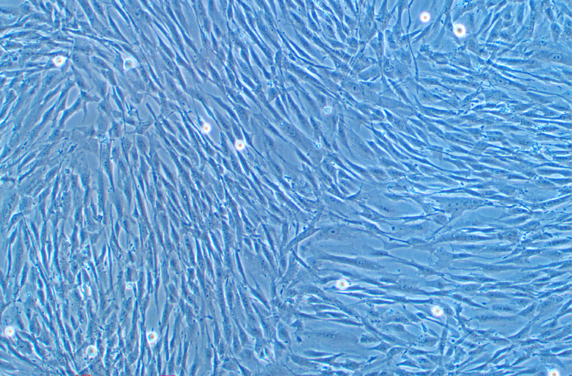 人主動脈瓣膜間質細胞
