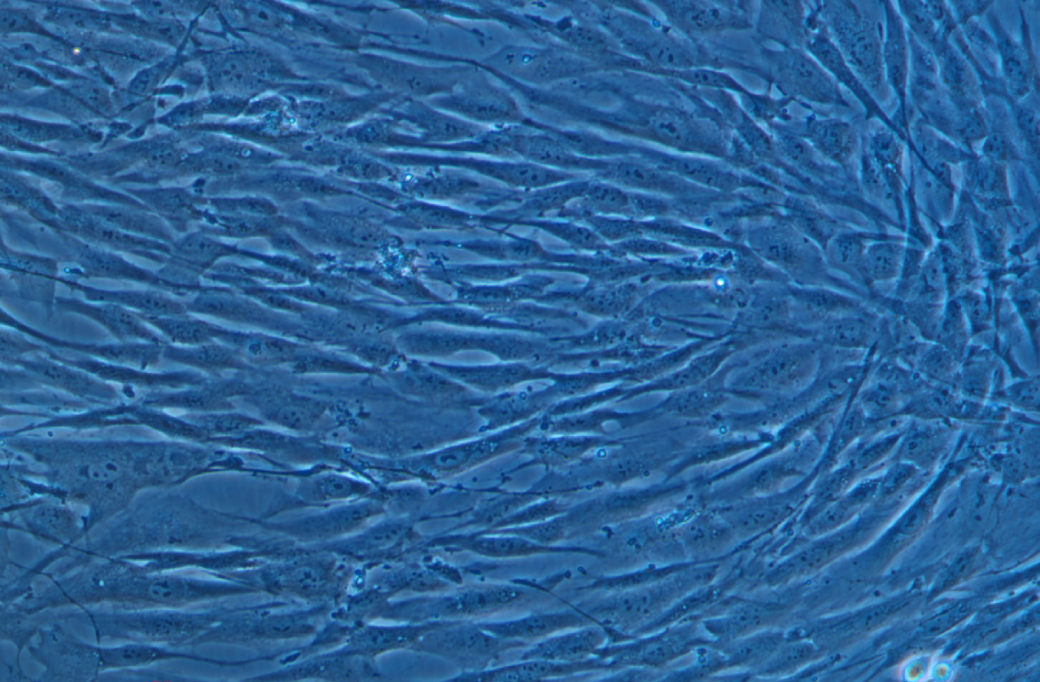 人主動脈瓣膜間質細胞