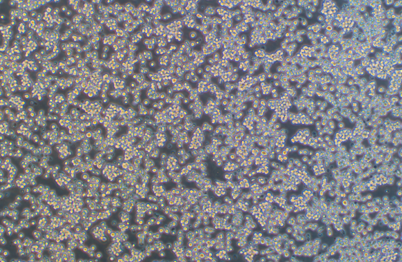 人急性髓性嗜酸性粒細(xì)胞白血病細(xì)胞EOL-1(STR鑒定正確) ?