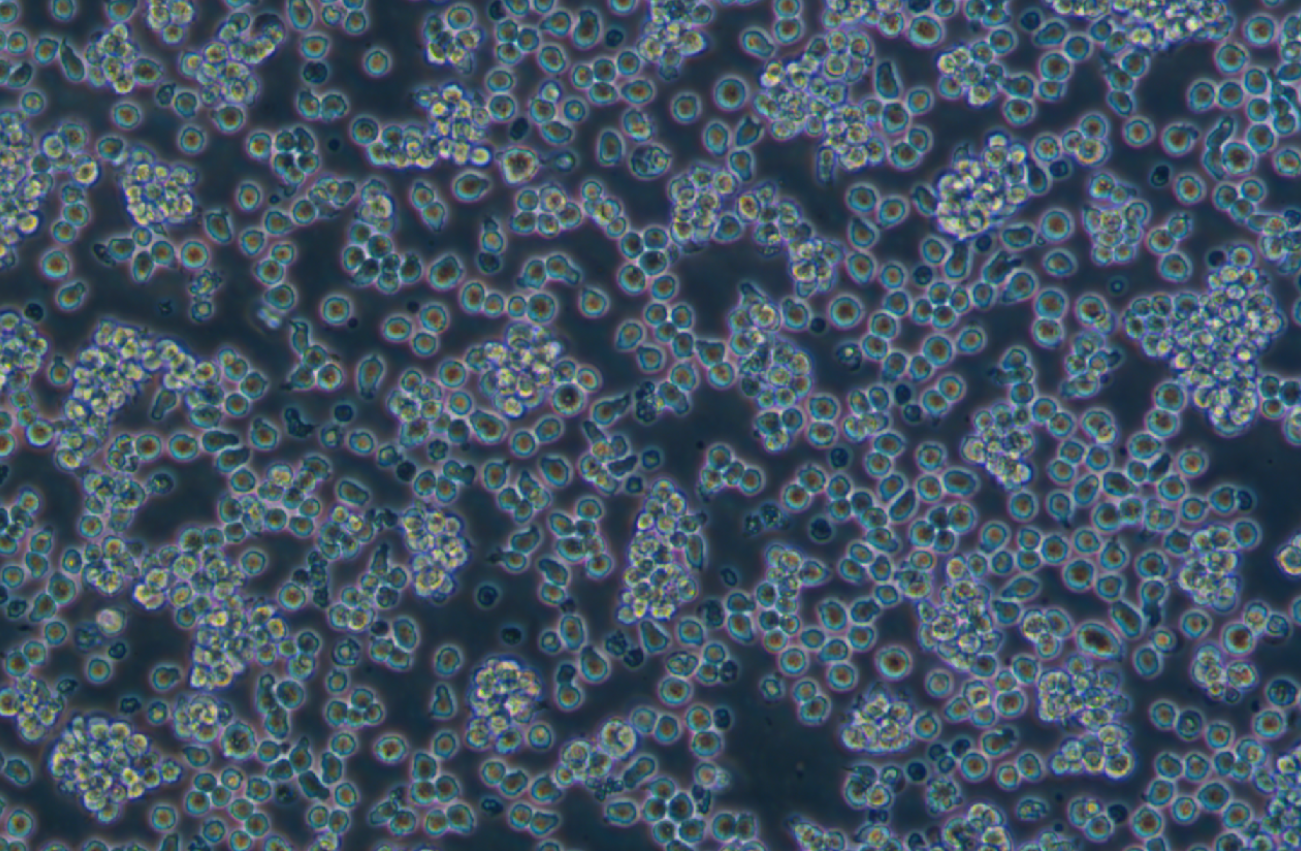 人急性髓性嗜酸性粒細(xì)胞白血病細(xì)胞EOL-1(STR鑒定正確) ?