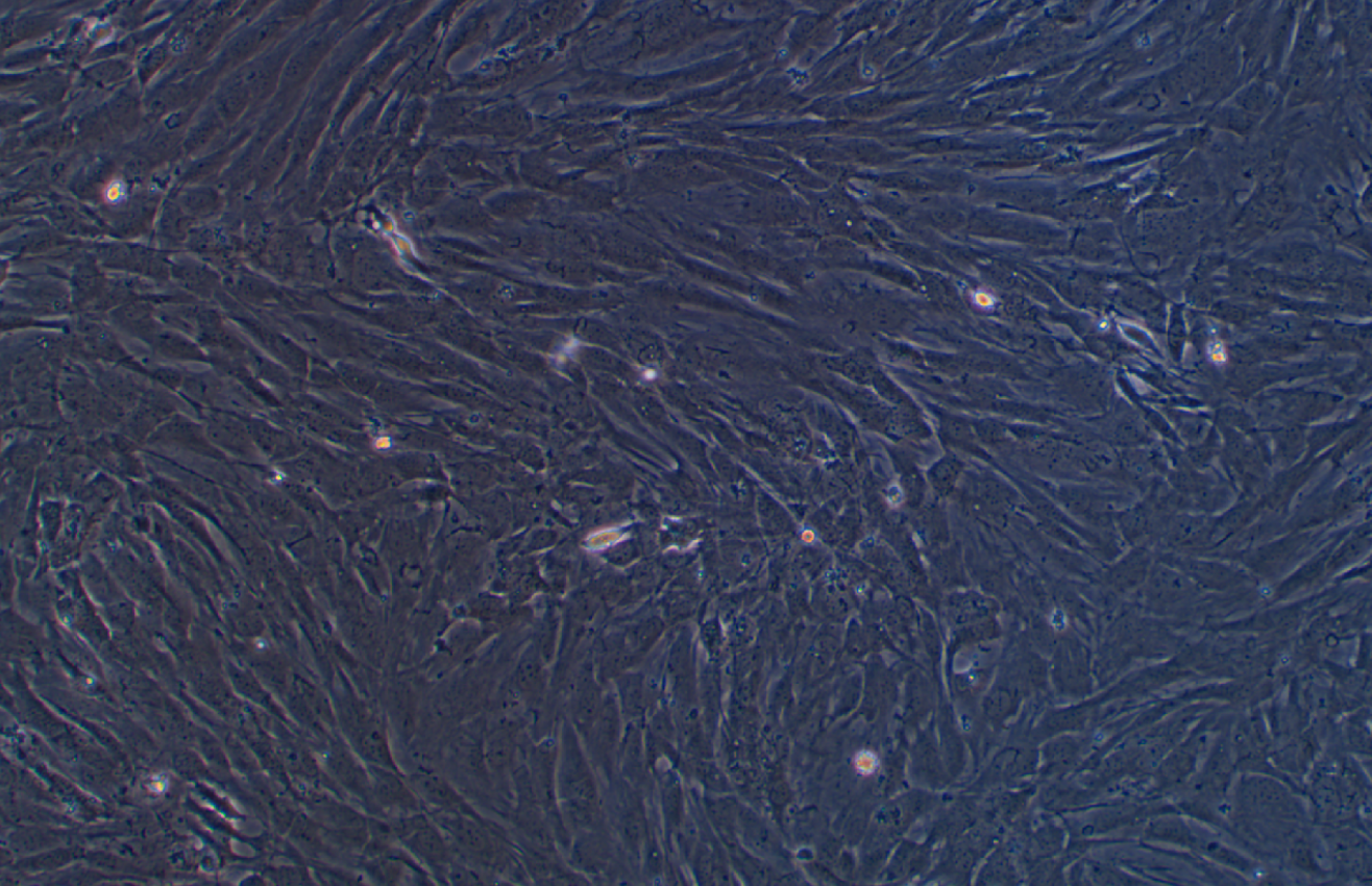 小鼠乳腺癌細胞AT-3(種屬鑒定)