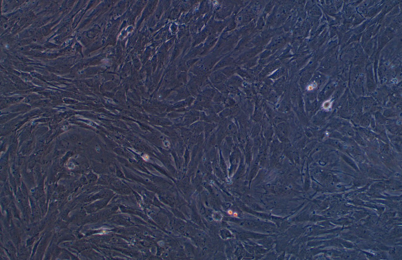 小鼠乳腺癌細胞AT-3(種屬鑒定)