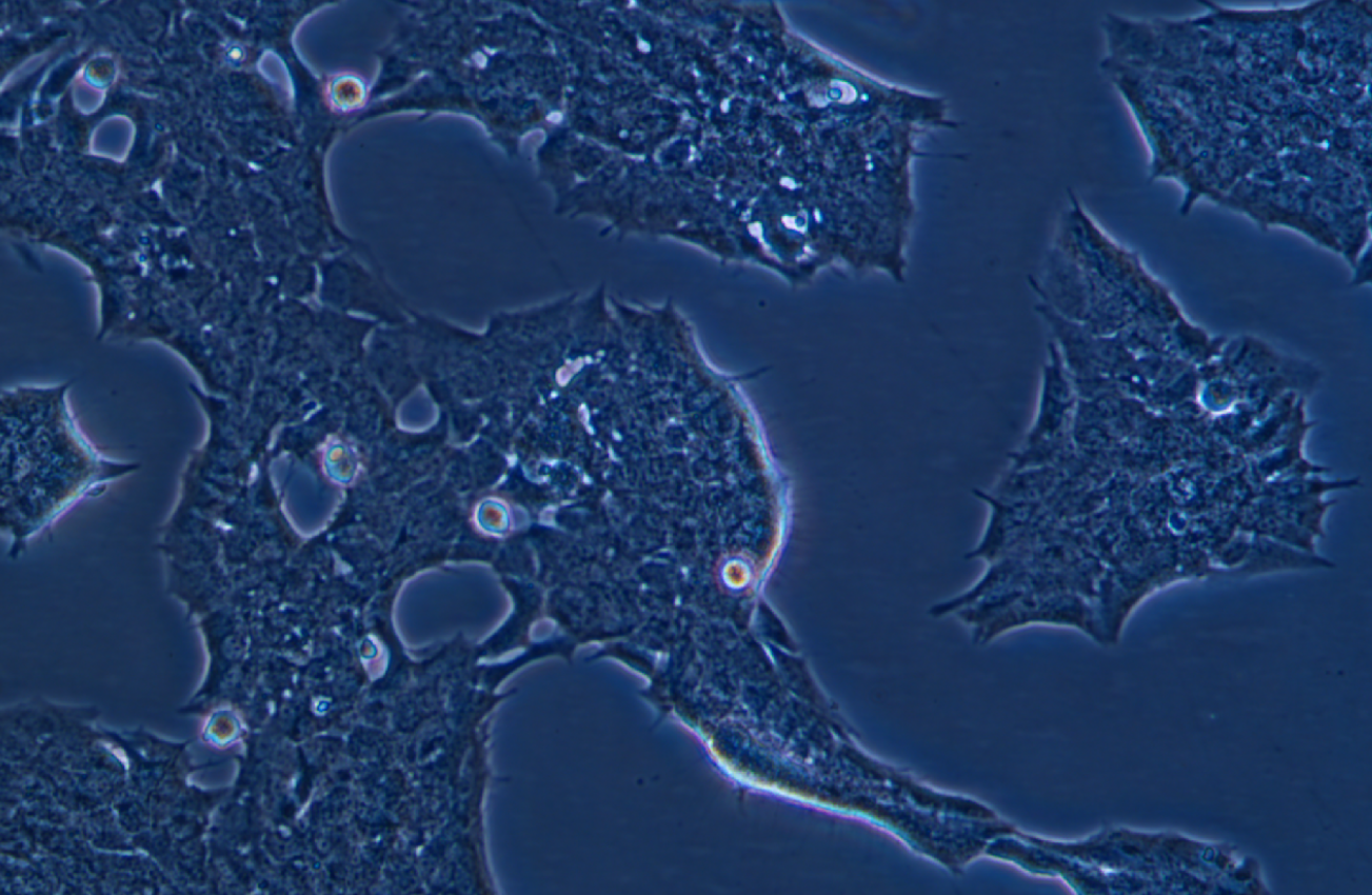 小鼠垂體瘤細(xì)胞GT1-1(種屬鑒定)