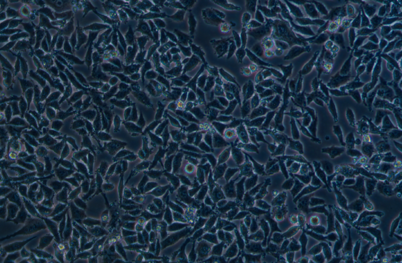 人結腸癌細胞(低分化)RKO (STR鑒定正確)