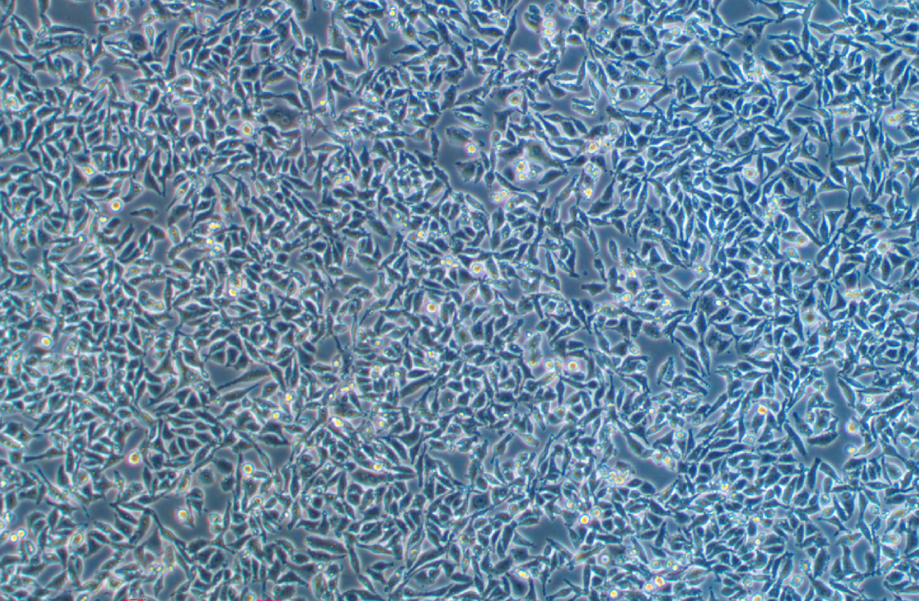 人結腸癌細胞(低分化)RKO (STR鑒定正確)