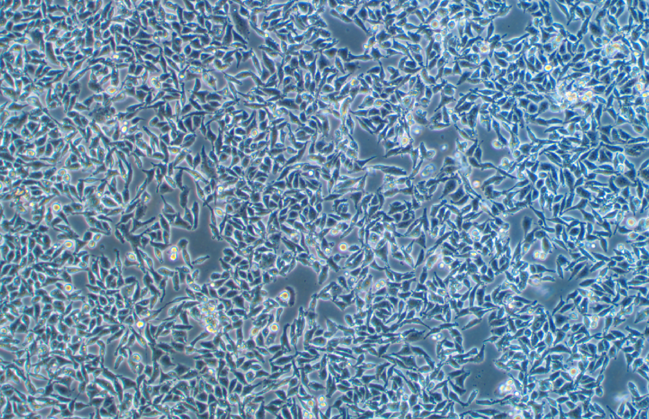 人結腸癌細胞(低分化)RKO (STR鑒定正確)