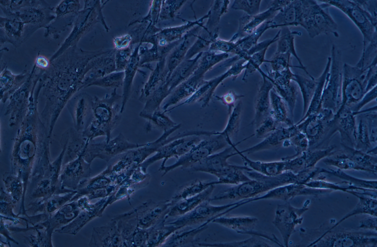 人腦星形膠質細胞瘤細胞SW1088 (STR鑒定正確)