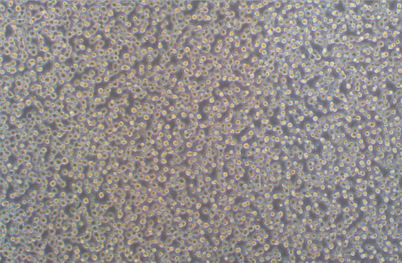 人慢性髓系白血病細胞扎轉染熒光素酶K562+LUC(STR鑒定正確)