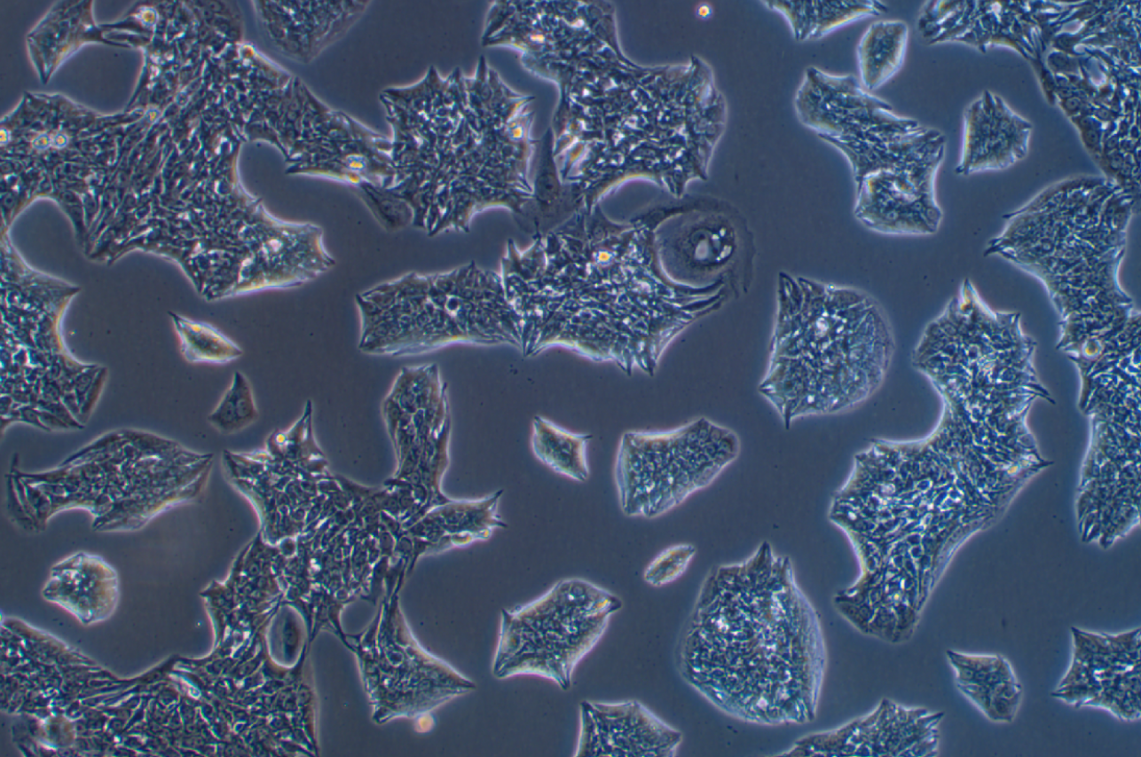 人肺癌腺癌細胞LC-2/AD? (STR鑒定正確)