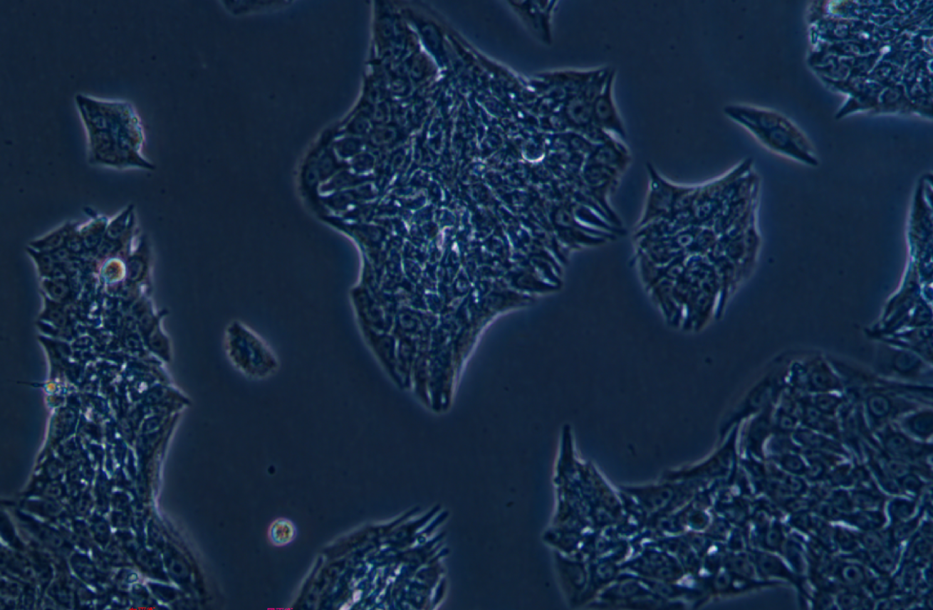 人肺癌腺癌細胞LC-2/AD? (STR鑒定正確)