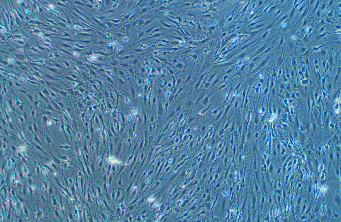 小鼠肺微血管內(nèi)皮細(xì)胞
