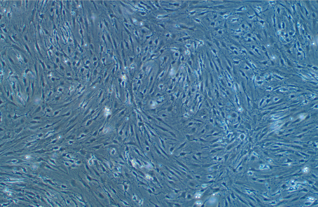 小鼠肺微血管內(nèi)皮細(xì)胞