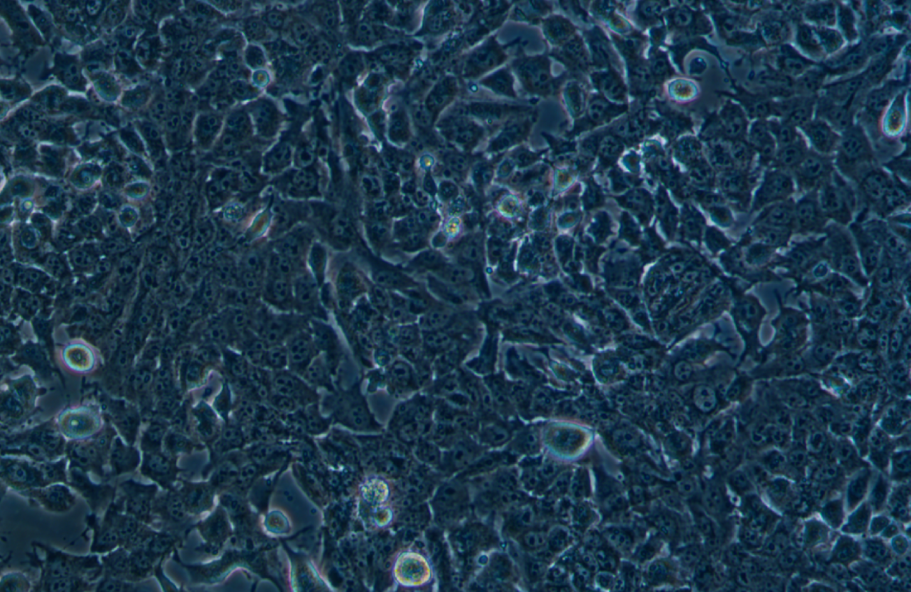 小鼠肝癌細胞Hepa 1-6+OVA(STR鑒定正確)