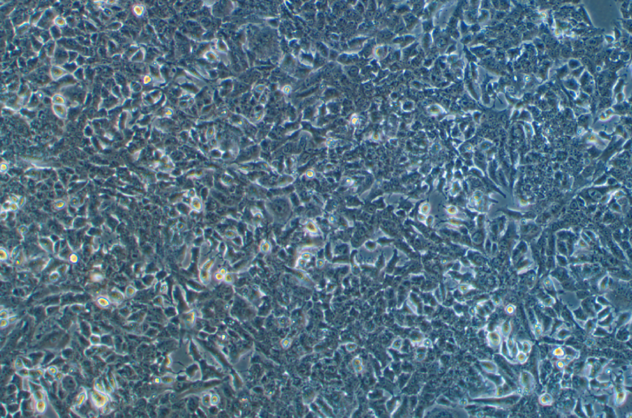 小鼠肝癌細胞Hepa 1-6+OVA(STR鑒定正確)