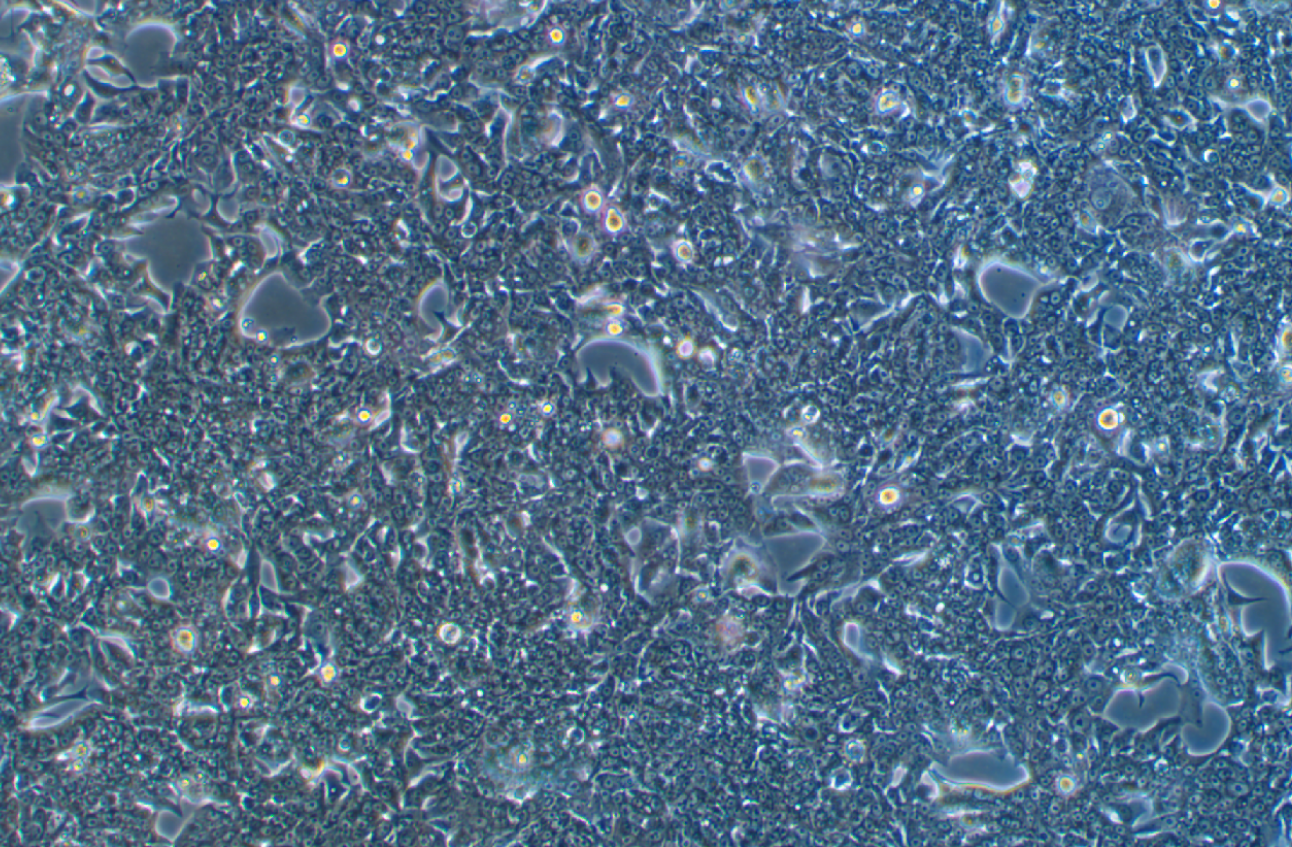 人直腸腺癌細胞SW837(STR鑒定正確)