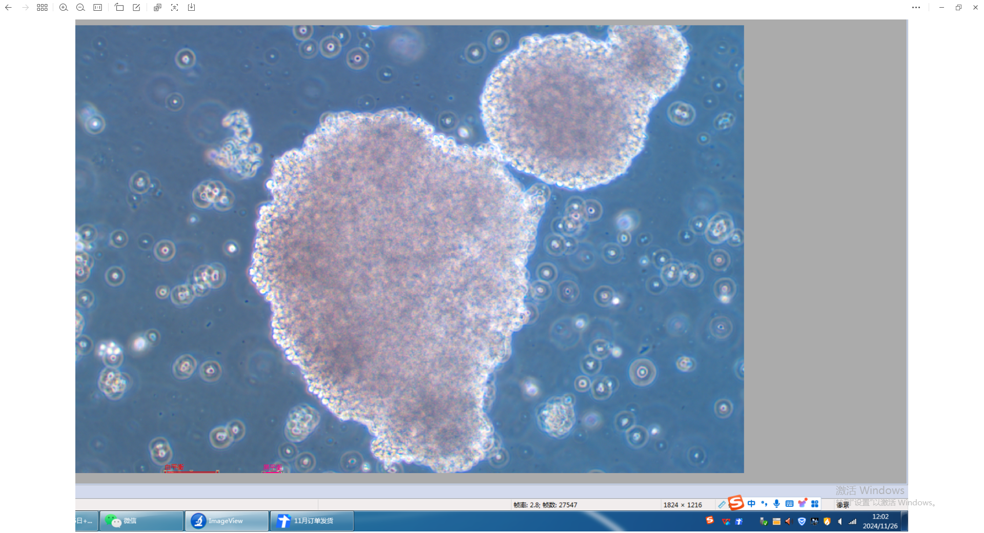 人惡性非霍奇金淋巴瘤患者的自然殺傷細(xì)胞NK-92MI (STR鑒定正確)