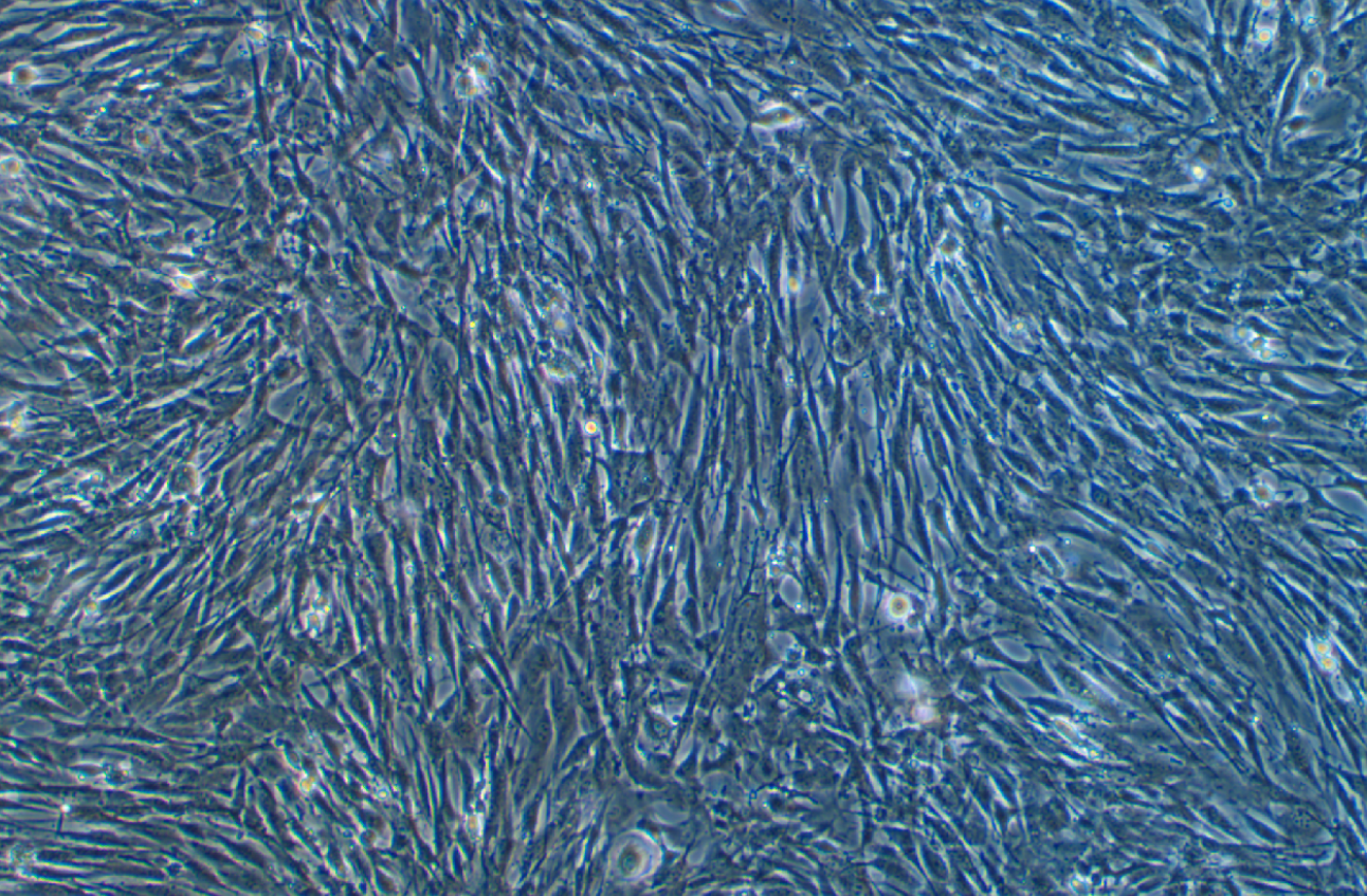 羊睪丸間質細胞