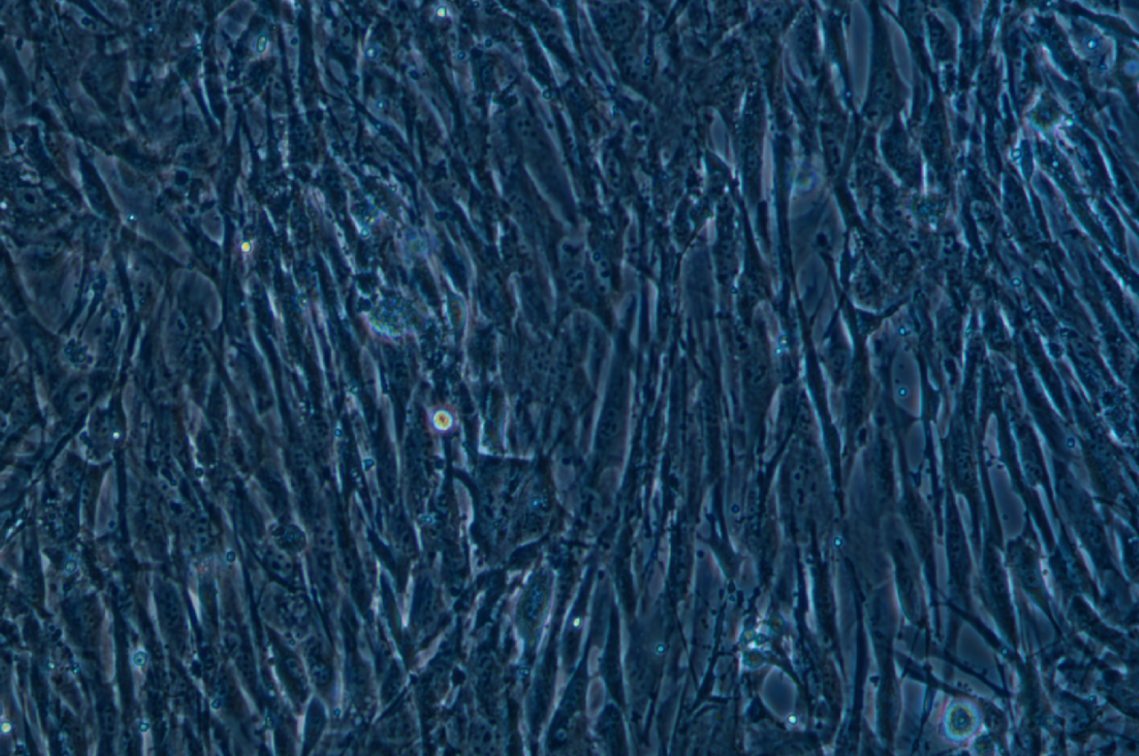 羊睪丸間質細胞