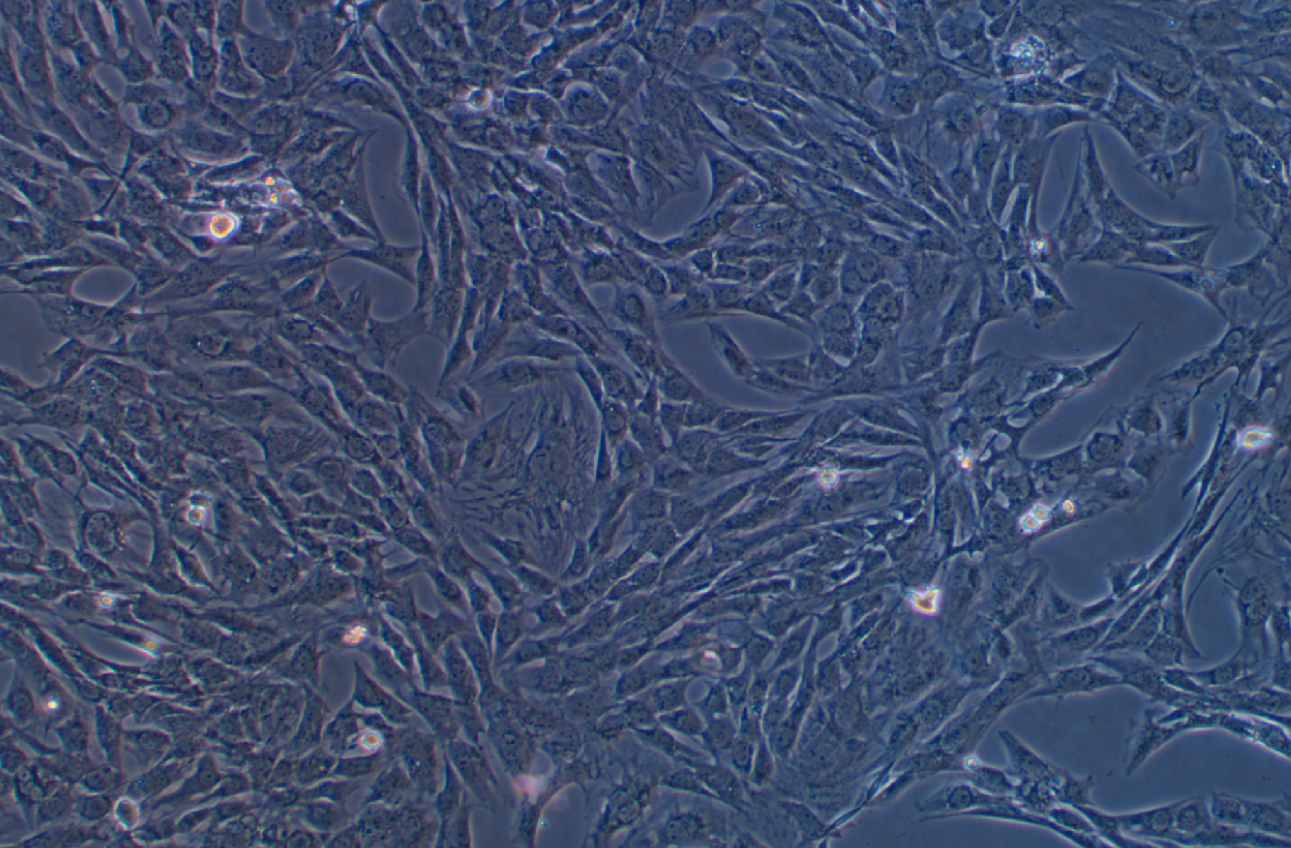 人乳腺癌成纖維細胞永生化