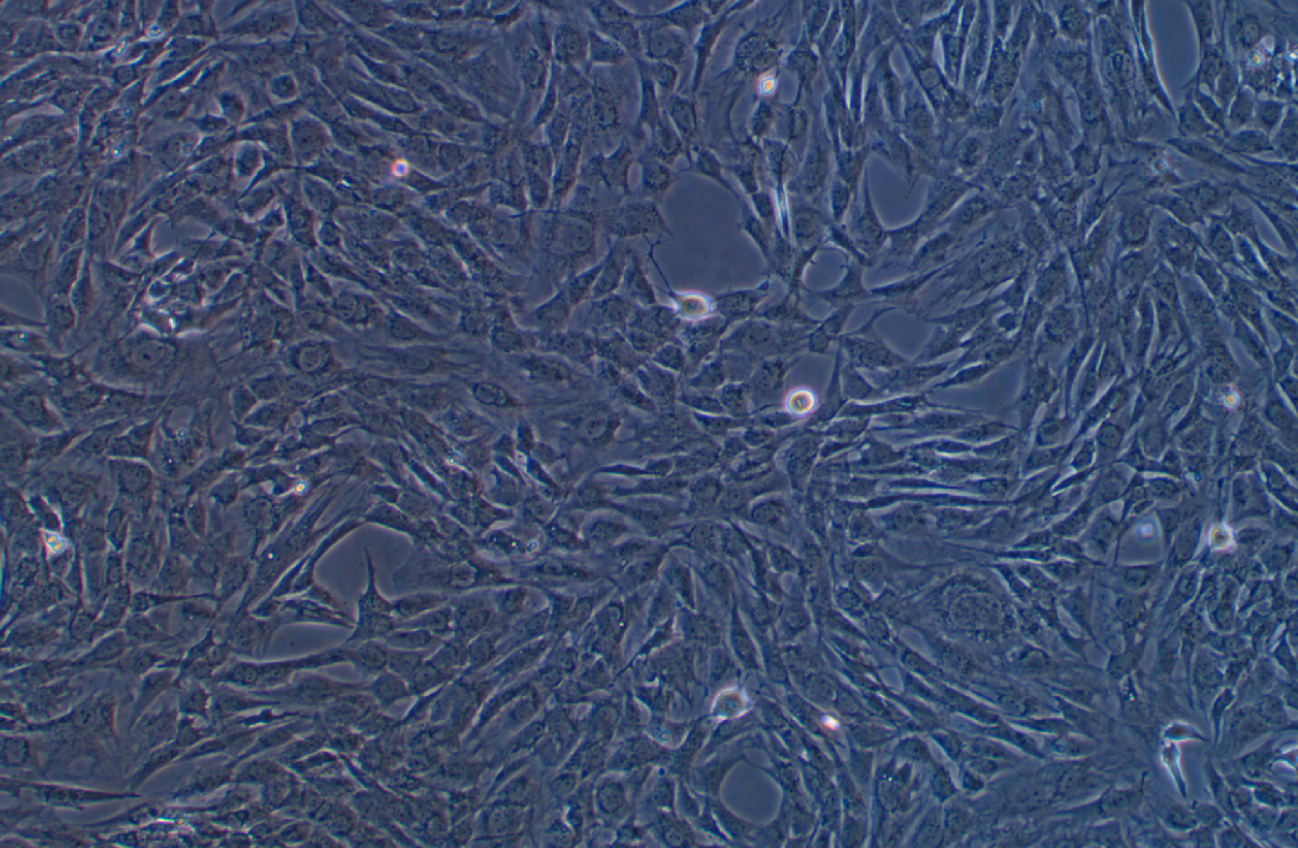人乳腺癌成纖維細胞永生化