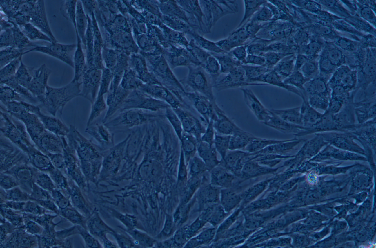 人乳腺癌成纖維細胞永生化