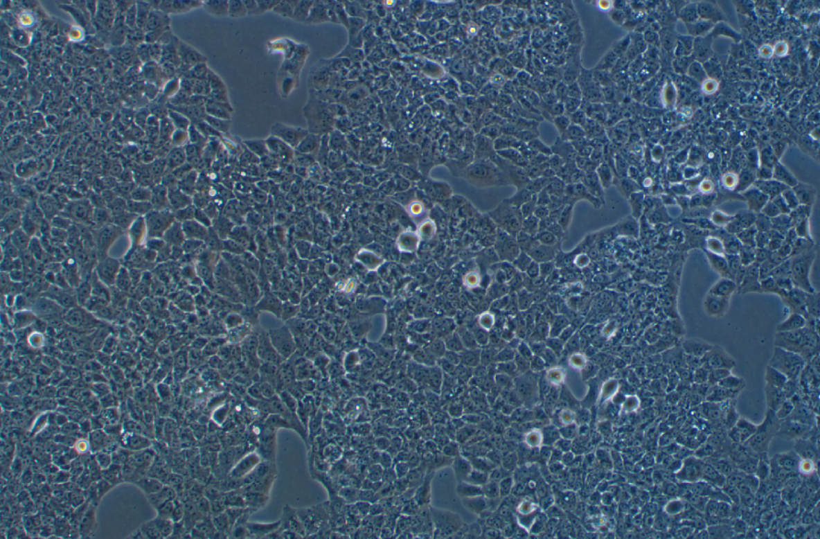 人子宮頸表皮癌細胞MS751(STR鑒定正確)