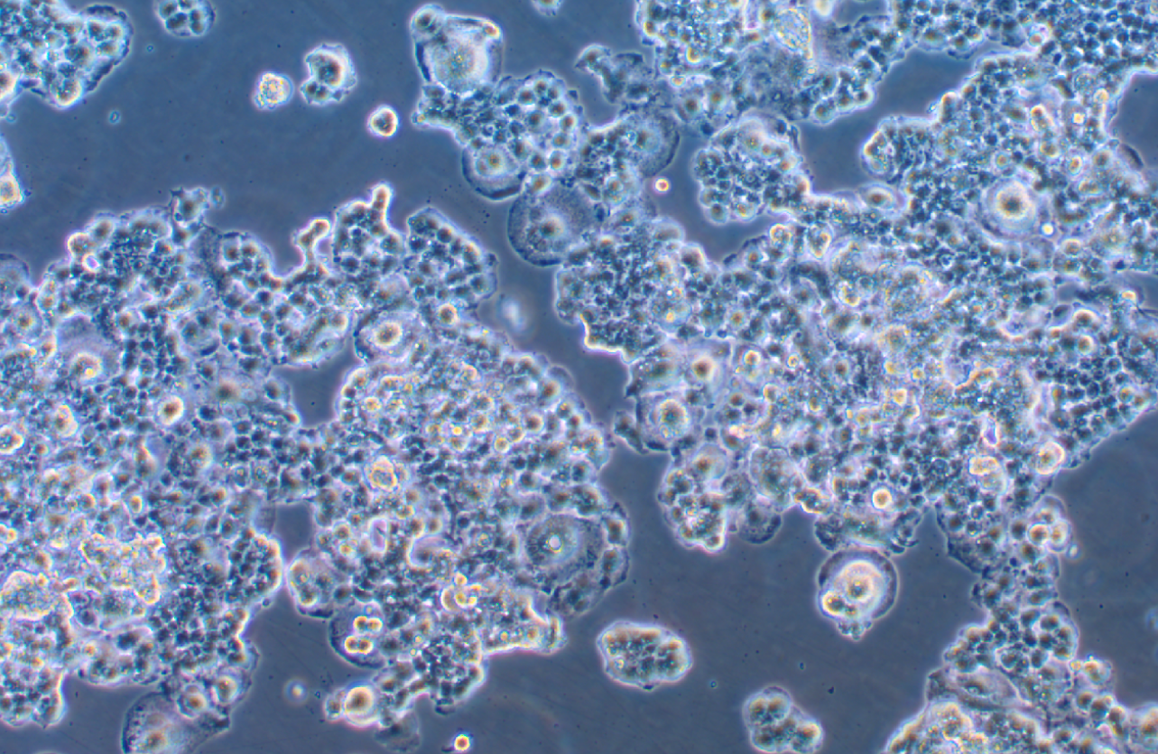 人胰腺癌細胞QGP-1(STR鑒定正確)