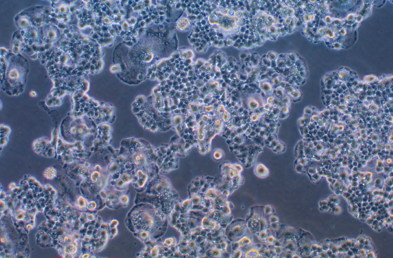 人胰腺癌細胞QGP-1(STR鑒定正確)