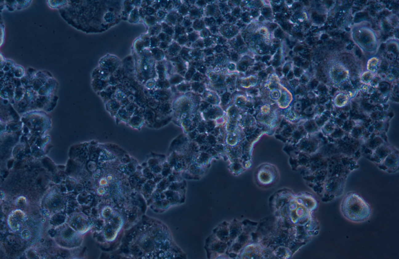 人胰腺癌細胞QGP-1(STR鑒定正確)