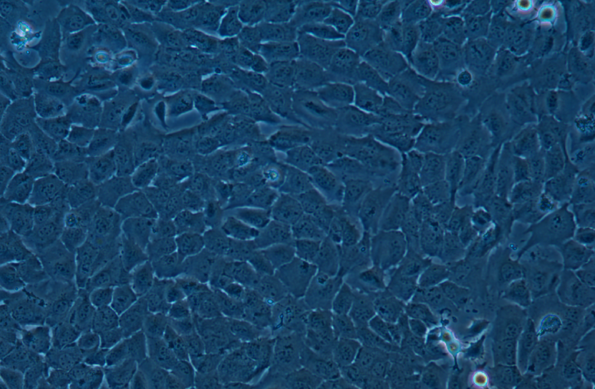 湖羊瘤胃上皮細胞永生化