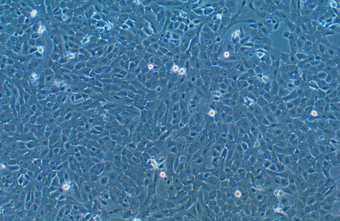 湖羊瘤胃上皮細胞永生化