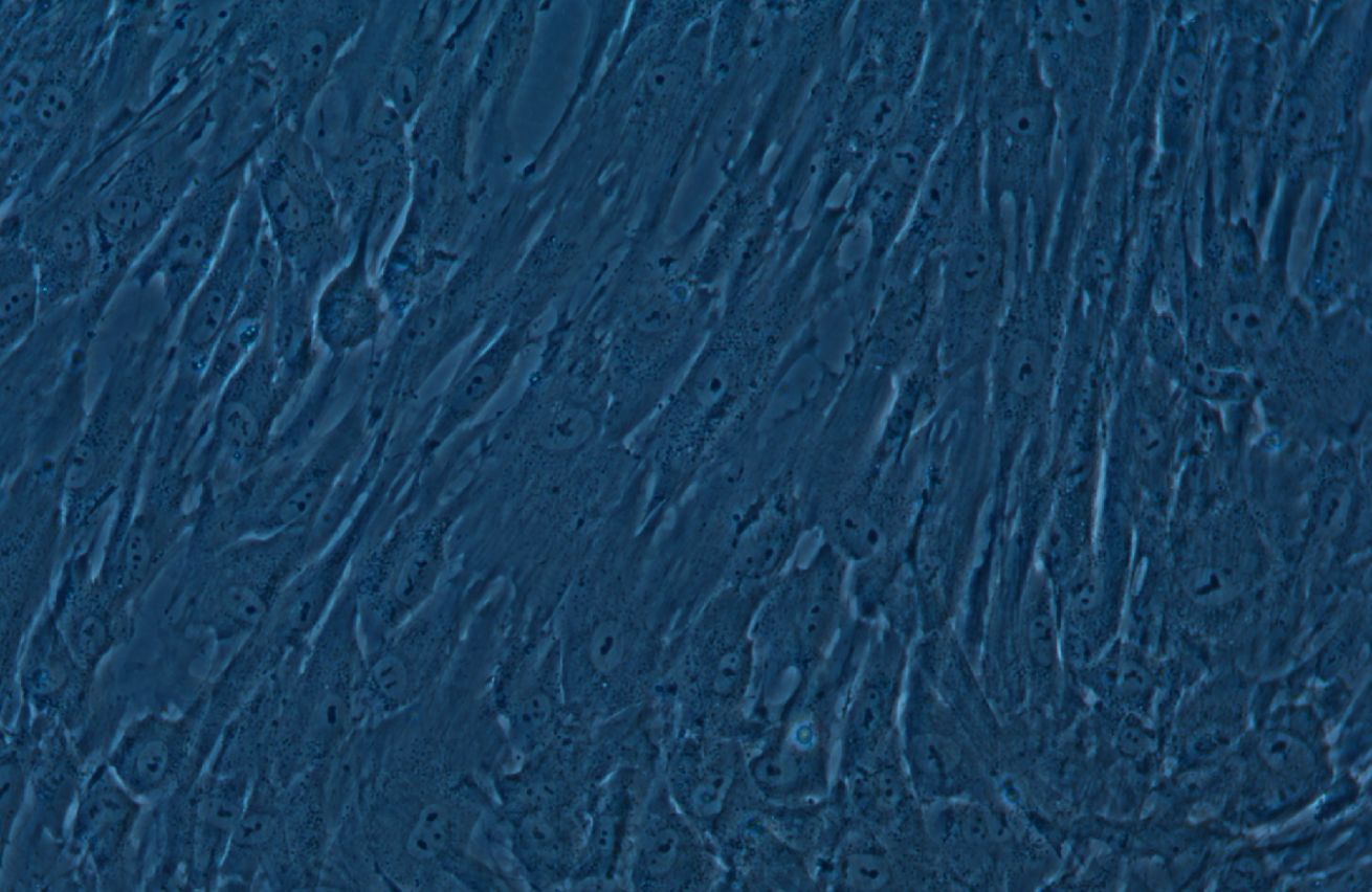 人骨髓間充質(zhì)干細(xì)胞