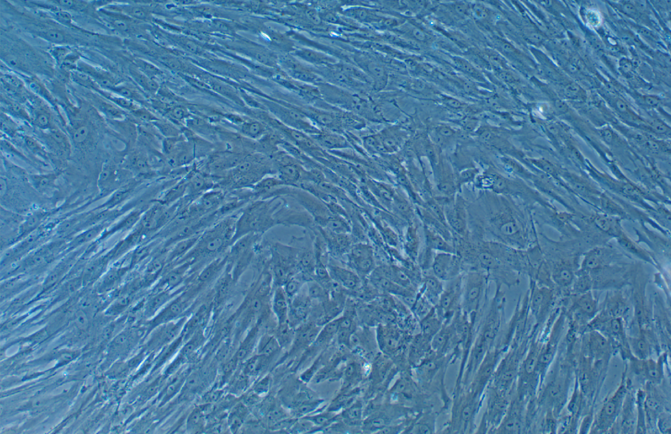 人骨髓間充質(zhì)干細(xì)胞