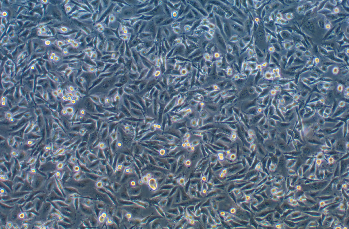 人乳腺癌細胞MDA-MB-231(STR鑒定正確)
