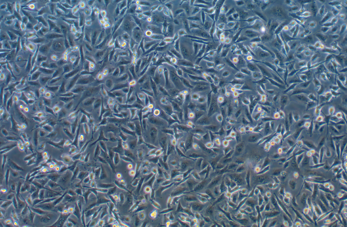 人乳腺癌細胞MDA-MB-231(STR鑒定正確)