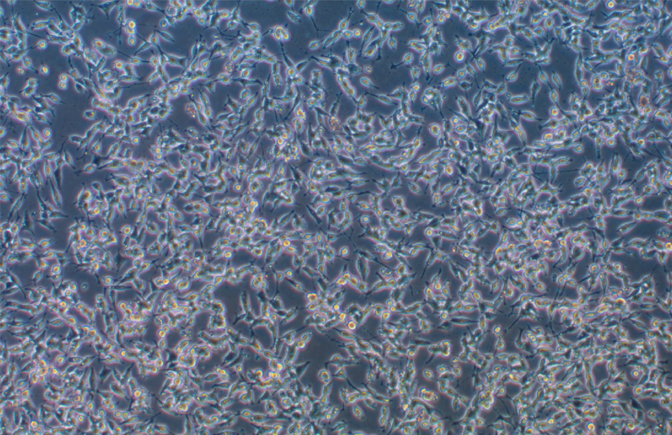 人神經(jīng)母細(xì)胞瘤細(xì)胞 NB1 (STR鑒定正確)