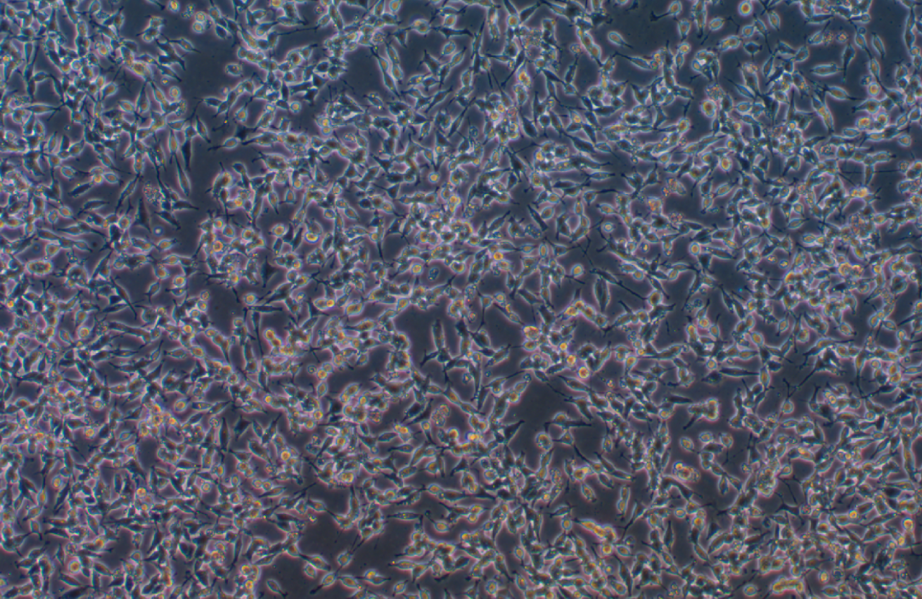 人神經(jīng)母細(xì)胞瘤細(xì)胞 NB1 (STR鑒定正確)